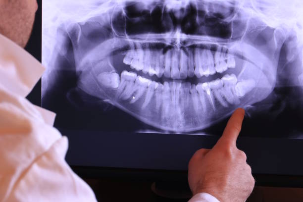 Best Emergency Root Canal Therapy in Lawrenceville, VA