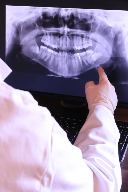 Best Emergency Treatment for Oral Infections in Lawrenceville, VA